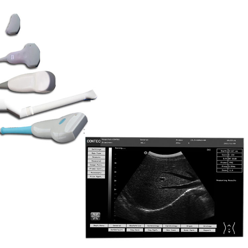 Sistema de diagnóstico por ultrasonido veterinario CMS600P2VET