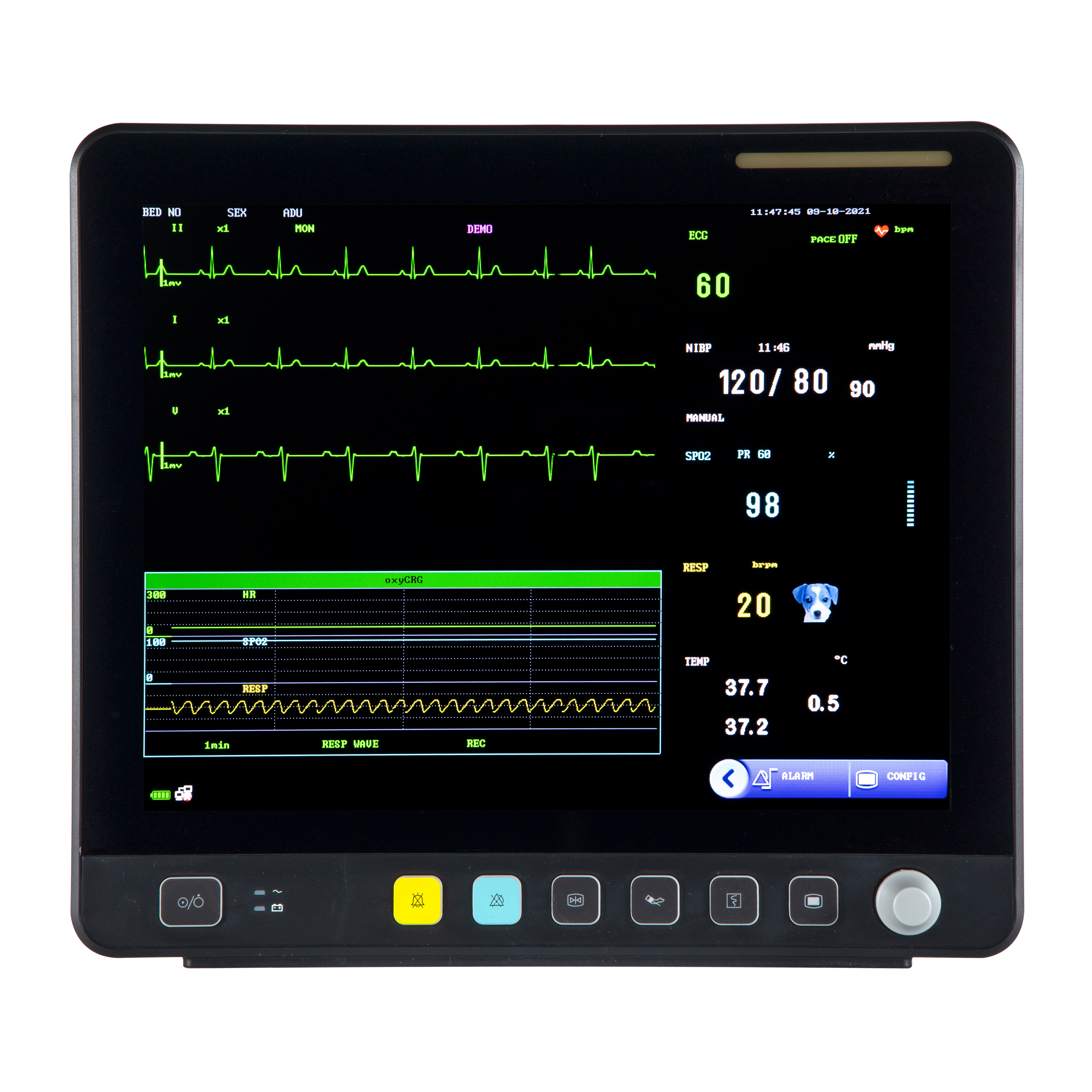 Monitor de ECG multiparamétrico con pantalla táctil veterinaria VE15